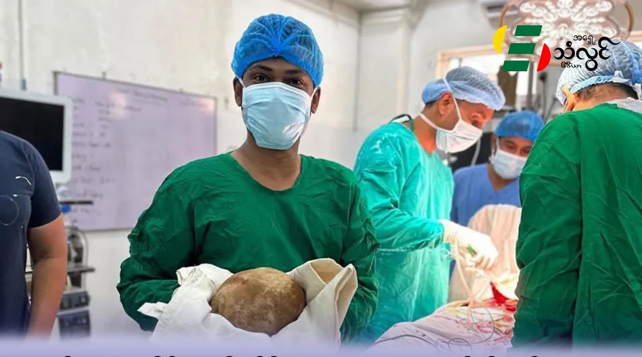အမျိုးသားတစ်ဦးရဲ့ ဆီးအိမ်ထဲက ၃ ဒဿမ ၁ ကီလိုဂရမ်လေးတဲ့ကျောက်ကို သီရိလင်္ကာဆရာဝန်များ အောင်မြင်စွာ ဖယ်ရှား